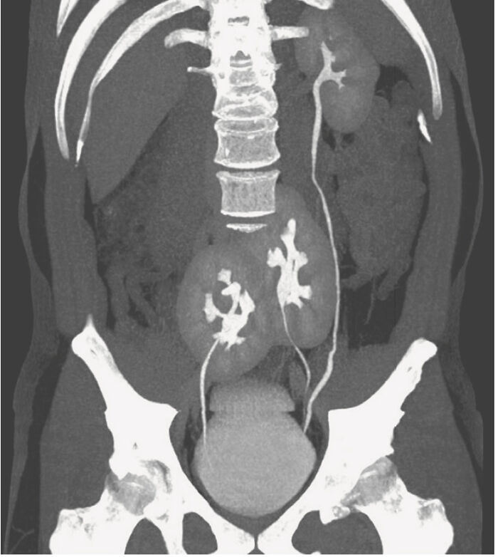 Radiografía médica mostrando órganos internos y estructura ósea como ejemplo de fotos médicas que demuestran que el cuerpo es a veces aterrador.