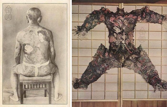 Hombre con tatuajes médicos detallados y traje tatuado, mostrando aspectos únicos y a veces aterradores del cuerpo humano.