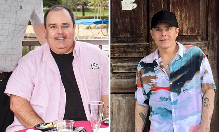 Hombre antes y después de cirugía plástica mostrando cambios irreconocibles en su apariencia física.