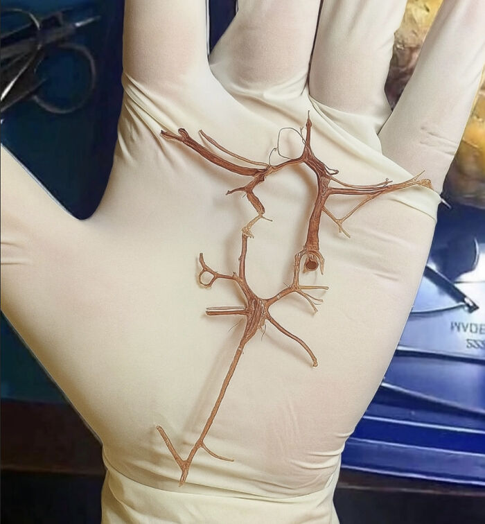 Mano con guante sosteniendo una imagen médica fascinante de una estructura vascular extraída, foto médica impactante y única.