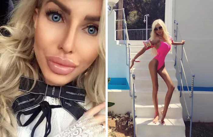 Mujer con transformaciones extremas de cirugías plásticas muestra cambios impactantes en rostro y figura estilizada.