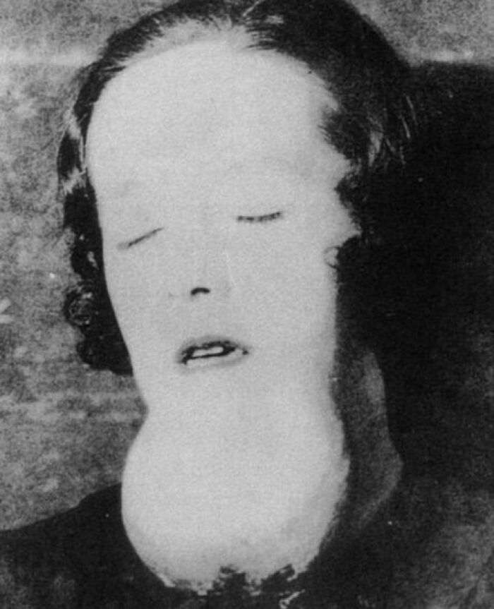 Fotografía histórica en blanco y negro de un rostro con deformidad, mostrando datos históricos interesantes poco conocidos.