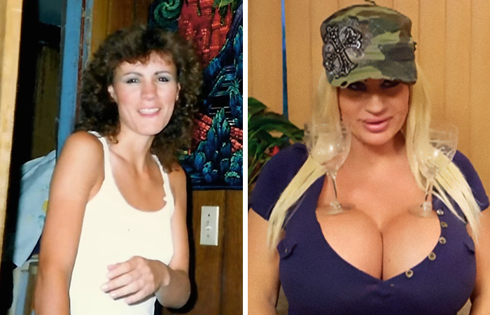 Mujer antes y después de cirugías plásticas extremas mostrando transformación física impactante y cambios radicales.