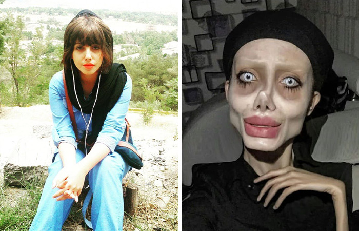 Mujer antes y después de cirugías plásticas extremas mostrando transformación impactante en su apariencia.