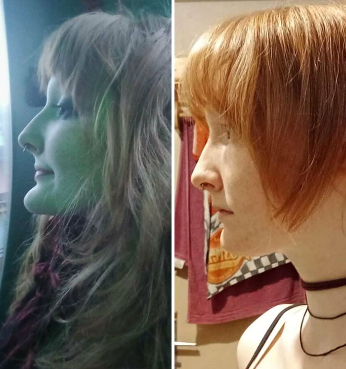Perfil antes y después de una mujer mostrando cambios notables tras su cirugía plástica y su aspecto irreconocible.