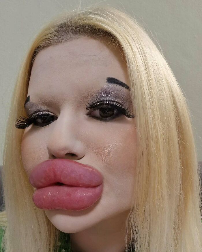 Mujer con los labios más grandes del mundo mostrando labios extremadamente aumentados y maquillaje en primer plano.