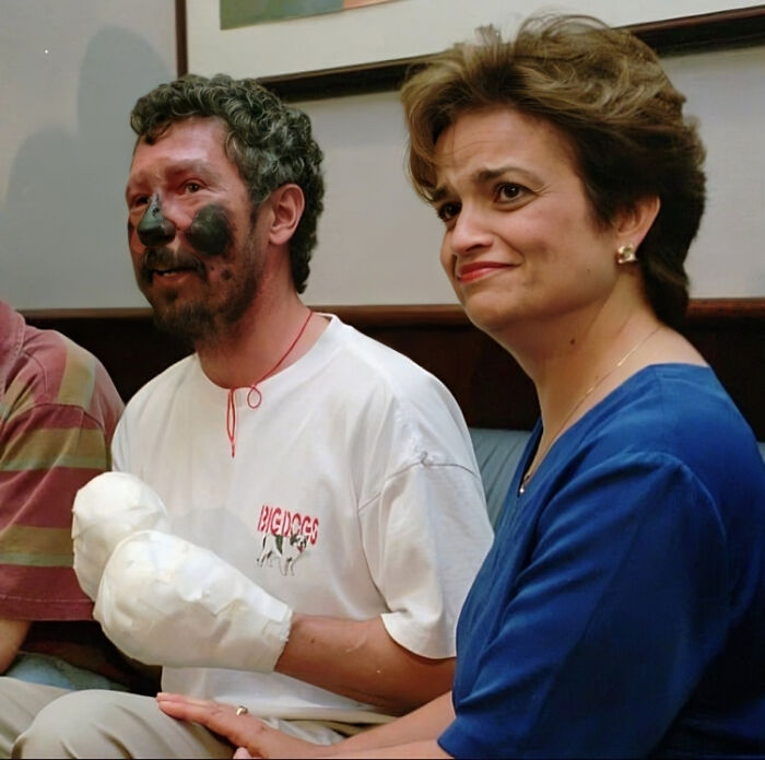 Hombre con pintura negra en la cara y mano vendada junto a mujer en foto antigua con contexto y fotos viejas.