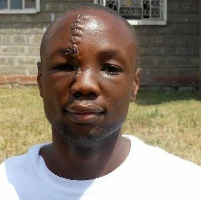 Hombre con cicatriz en el rostro al aire libre representando datos curiosos morbosos no aptos para cardíacos.