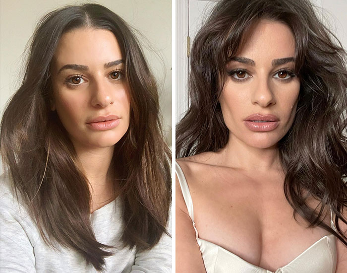 Mujer en fotos de antes y después, mostrando cambios visibles por cirugía plástica en transformación de celebridades.