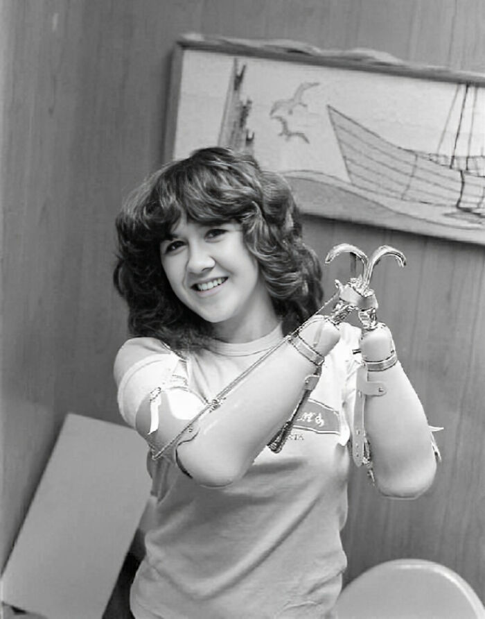 Joven sonriente con prótesis de manos en foto antigua en blanco y negro, mostrando contexto de fotos viejas.