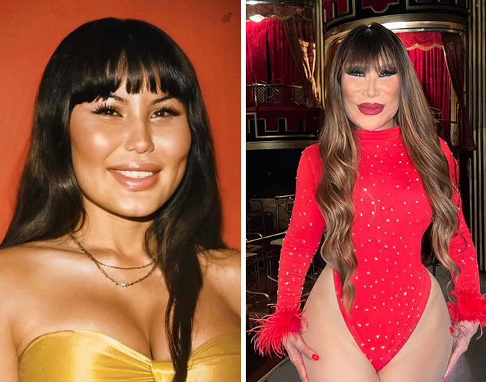 Antes y después de celebridad mostrando cambios visibles tras cirugía plástica en rostro y cuerpo con vestuario llamativo.