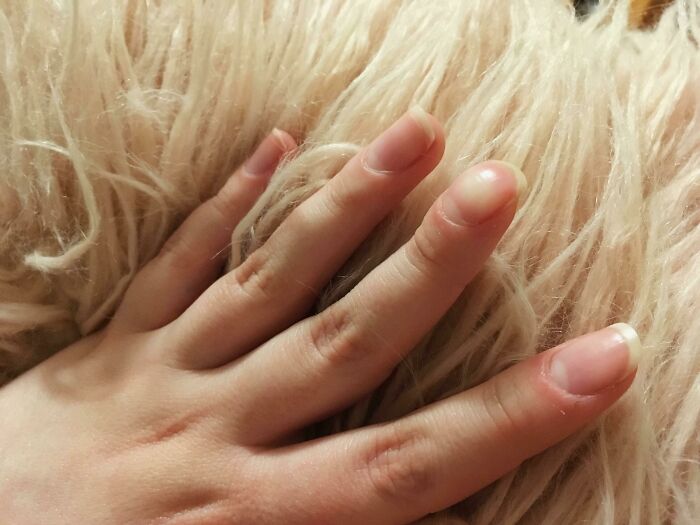 Mano femenina con piel clara y uñas naturales sobre superficie de pelaje suave, destacando rasgos distintivos del cuerpo humano.