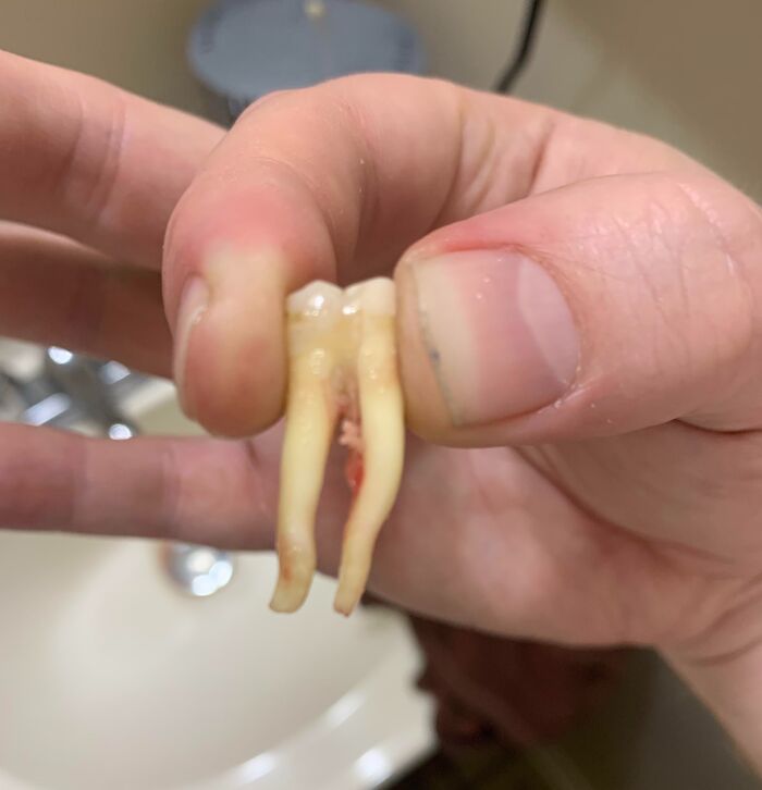 Mano sosteniendo un diente con raíces múltiples, uno de los rasgos distintivos del cuerpo humano que destacan a la gente.