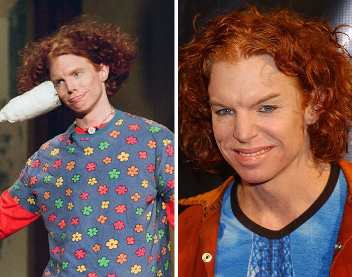 Comparación de antes y después de celebridad con cambios visibles por exceso de cirugía plástica en el rostro y cabello rojo.
