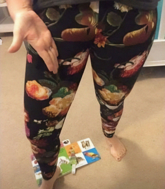 Leggings con diseño floral que crean un fallo de diseño divertido y visualmente confuso en las piernas de la persona.