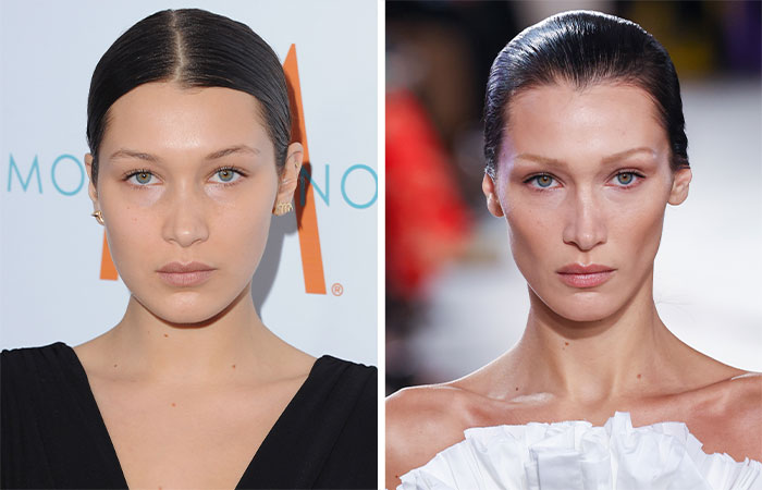 Bella Hadid en dos imágenes comparativas, mostrando cambios faciales que algunos atribuyen a la eliminación de grasa bucal.