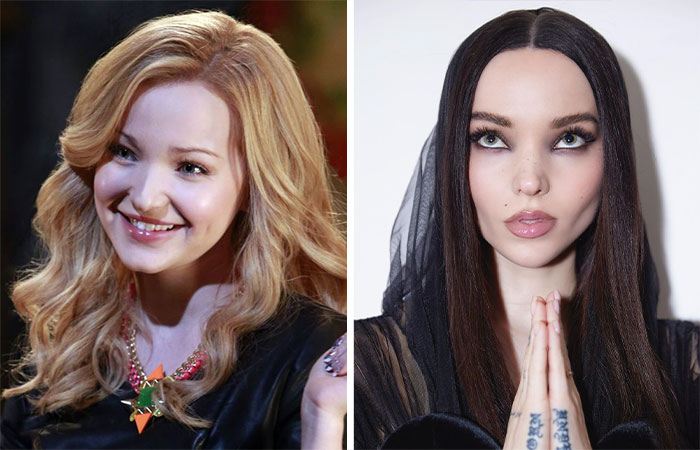 Dos celebridades comparando su belleza facial antes y después de la eliminación de grasa bucal, resaltando cambios notorios.