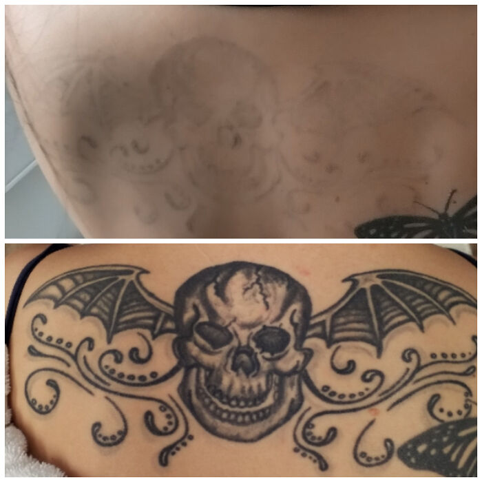 Imagen mostrando antes y después de la eliminación de tatuaje de calavera con alas en la espalda.