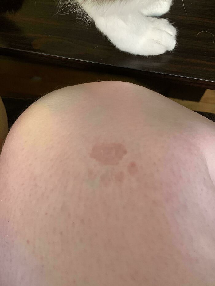 Huella adorable de pata de gato en la piel, mostrando la ternura de las marcas sin necesidad de un maullido.