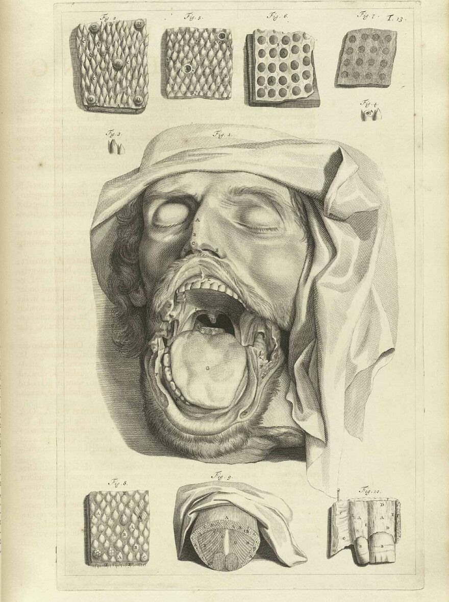 I Found This 18th Century Medical Illustration While Looking For Drawing Reference