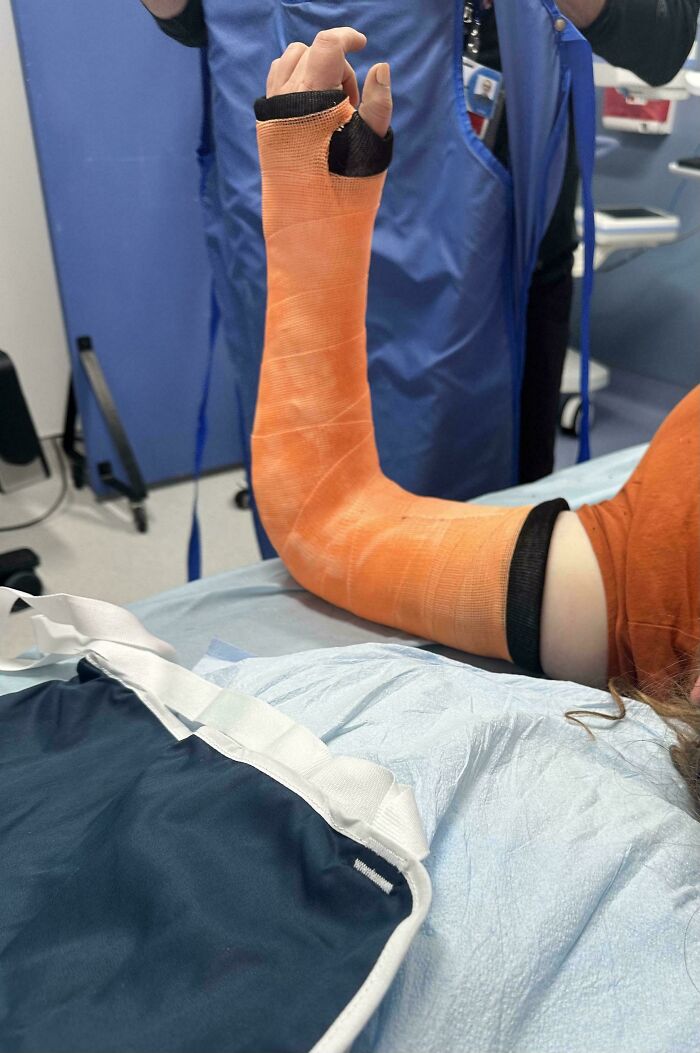 Brazo con yeso naranja en hospital, ejemplo de fotos de vacaciones que no salieron como se esperaba.