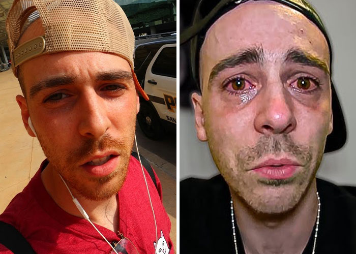 Hombre influencer con gorra, antes y después, mostrando el impacto de escándalos que arruinaron su carrera rápidamente.