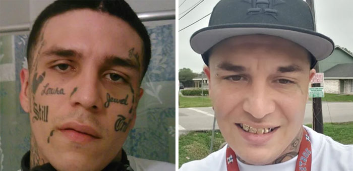 Hombre mostrando cambio significativo en su rostro antes y después de la eliminación de tatuajes efecto transformación visible.
