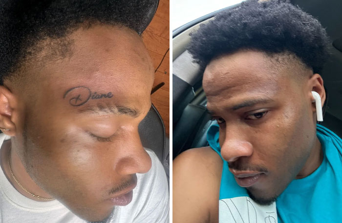 Hombre mostrando antes y después de la eliminación de tatuaje en el rostro, cambio notable en su apariencia.