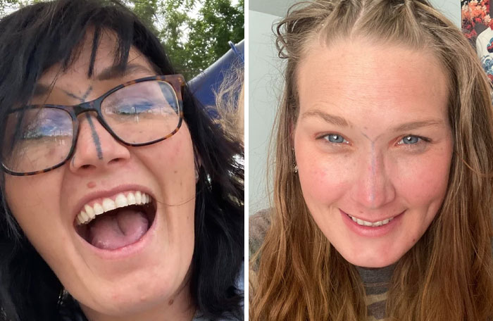 Mujer sonriente antes y después de la eliminación de tatuajes mostrando resultados sorprendentes del cambio de vida.