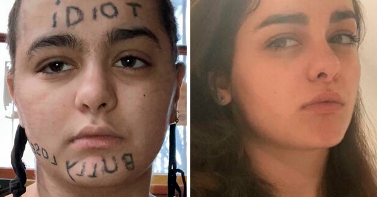 Primer plano de mujer antes y despuu00e9s de borrarse un tatuaje facial, mostrando transformaciu00f3n notable en la piel.