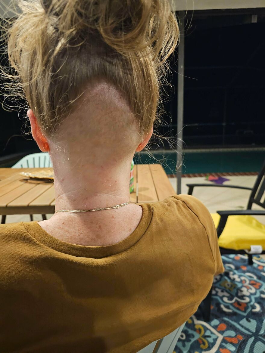 Persona mostrando corte undercut mal hecho en la nuca tras pagar 90 dólares en salón con mejores reseñas de la ciudad