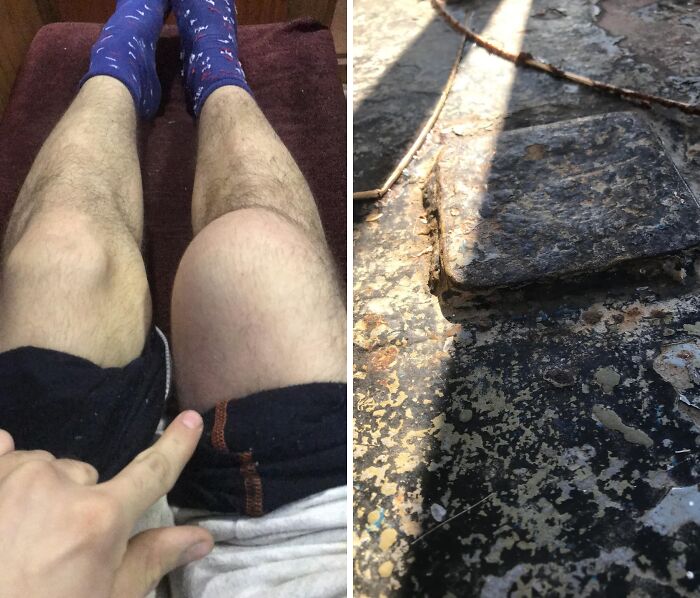 Persona señalando una inflamación extraña en la pierna, imagen relacionada con publicaciones médicas impactantes en línea.