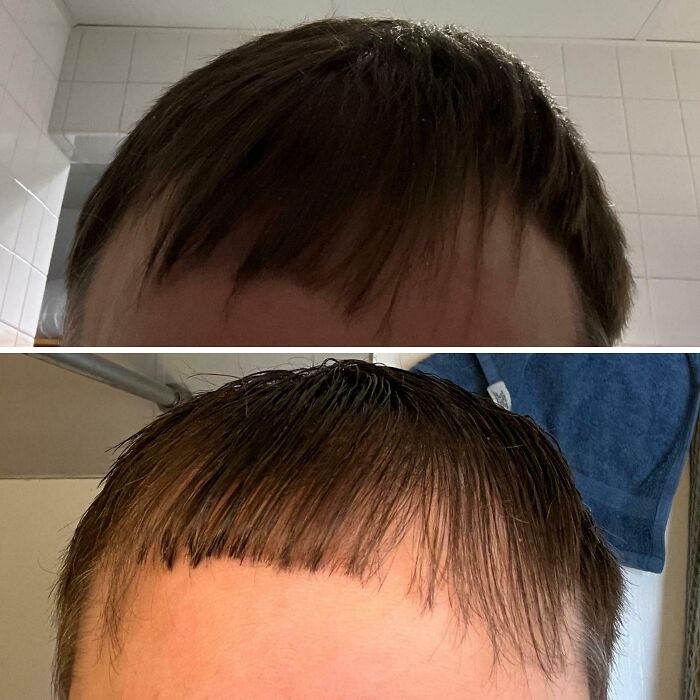 Cabello con cortes desiguales y accidentes capilares graciosos y trágicos en primeros planos de frente.