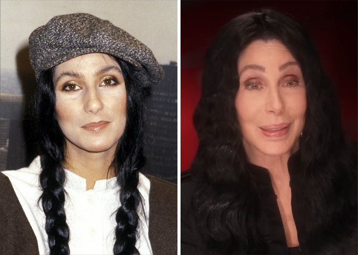 Imágenes comparativas de celebridades antes y después de sorprendentes transformaciones faciales que casi no parecen ellas mismas.