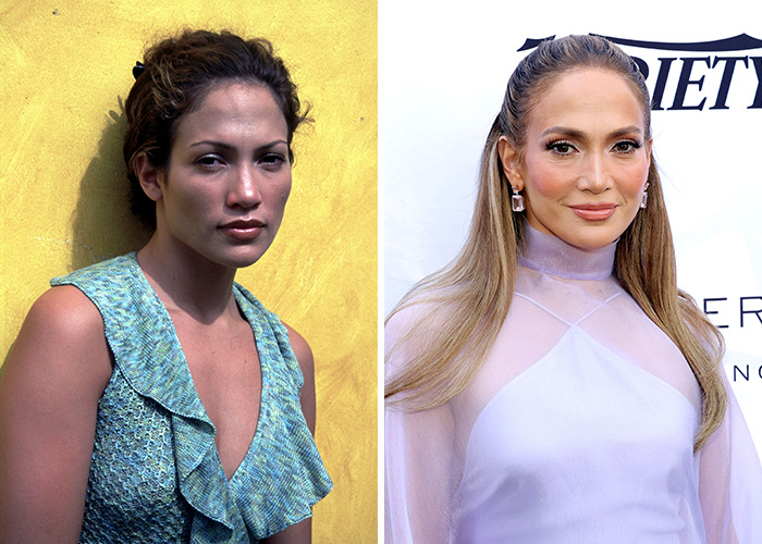 Comparación de la transformación impresionante de una estrella con cambios sorprendentes en su apariencia facial y estilo.