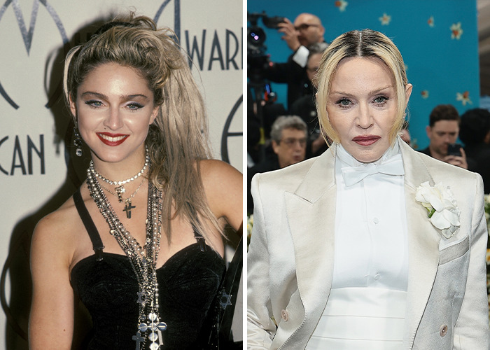 Madonna en dos fotos comparativas mostrando transformaciones sorprendentes de estrellas con cambios faciales notables.