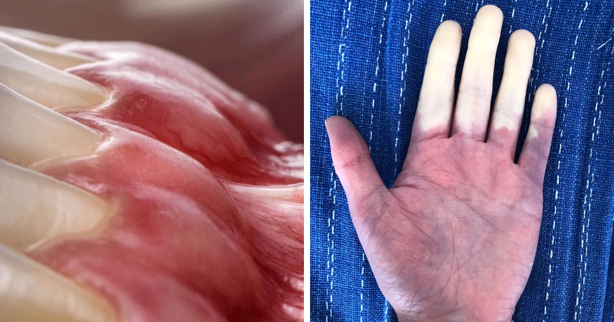 Primer plano de tejido muscular y mano con dedos descoloridos mostrando publicaciones mu00e9dicas extrau00f1as e inquietantes.