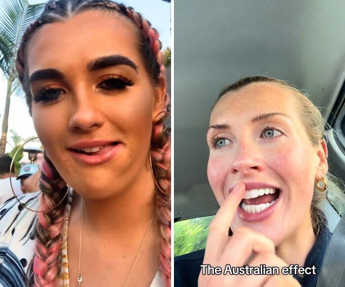 Mujer mostrando cambio antes y después de mudarse a Australia que demuestra el efecto australiano en su apariencia.