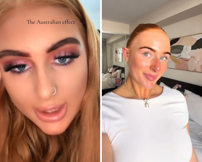 Antes y después del efecto australiano en rostro de mujer, mostrando cambio claro tras mudanza a Australia.