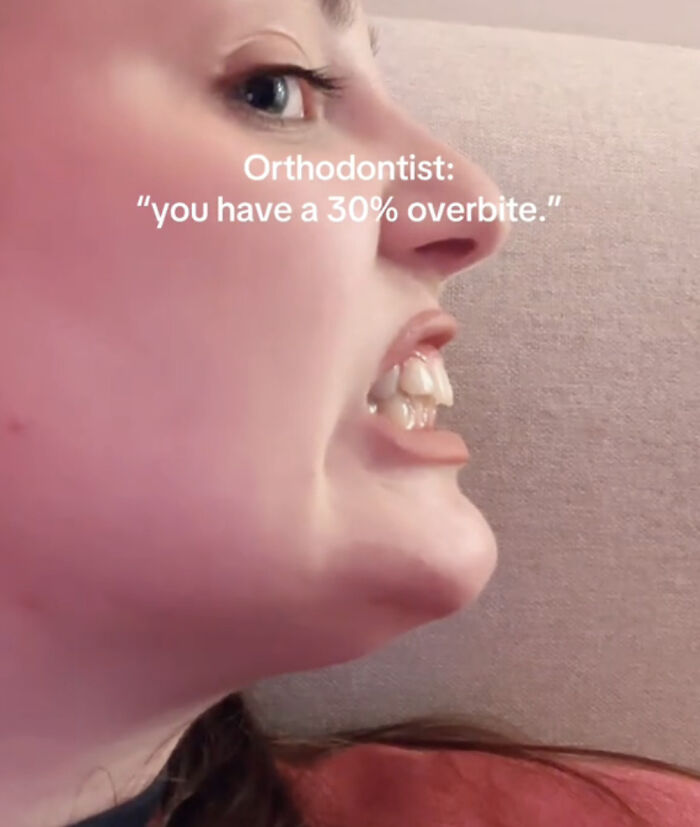 Mujer mostrando una sonrisa única y expresión facial especial que celebra su singularidad y confianza personal.