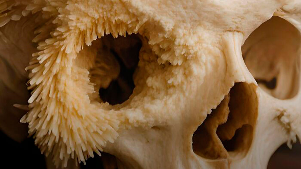 Calavera humana con formaciones extrau00f1as que representan hechos interesantes y perturbadores sobre la mente y el cuerpo.