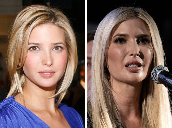 Comparación de transformaciones faciales Mar-a-Lago mostrando cambios sorprendentes en dos imágenes laterales.