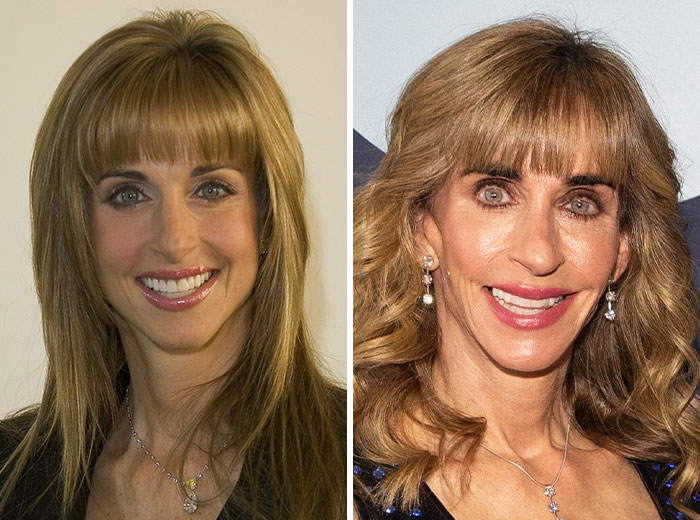 Transformaciones faciales impactantes en Mar-a-Lago, mostrando cambios sorprendentes en el rostro femenino con diferentes estilos y edades.