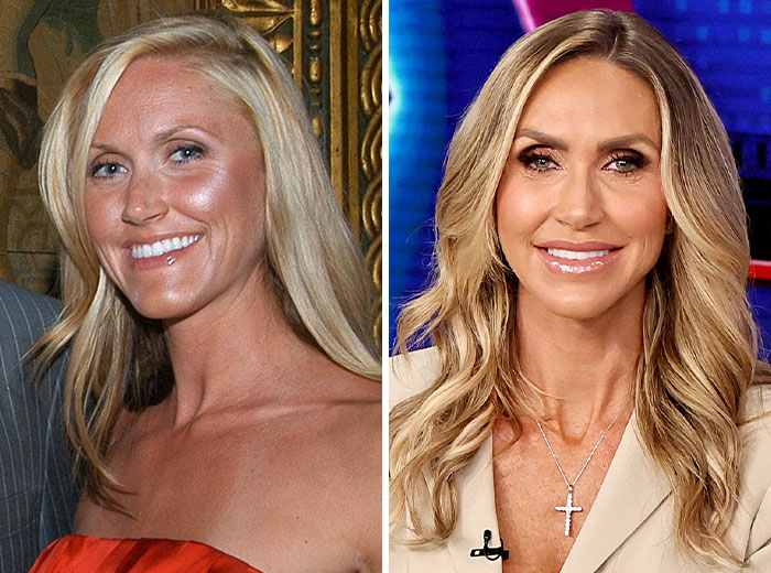 Transformaciones faciales Mar-a-Lago comparando cambios de apariencia sorprendentes en dos fotos de una mujer rubia con fondo distinto.