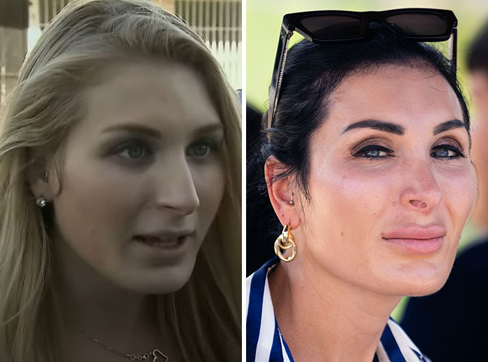 Transformaciones faciales impactantes de Mar-a-Lago en primer plano de dos mujeres con diferentes estilos y expresiones.